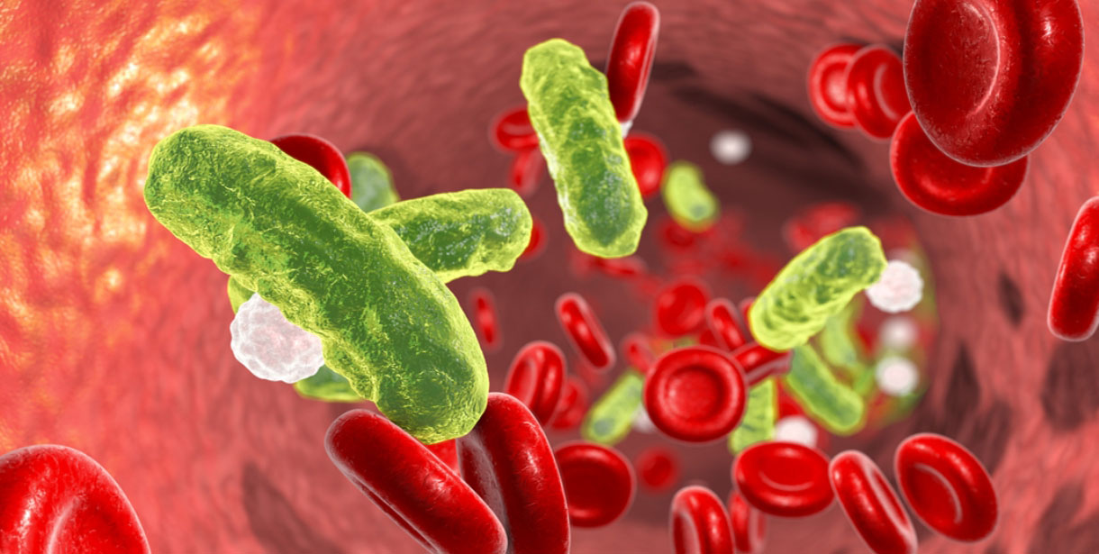 SEPSİSE'e Karşı 10 Etkili önlem
